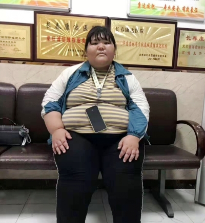 在长春康达医院成功减重161斤,爱美的她,轻松摆脱少女肥胖危机2.jpg