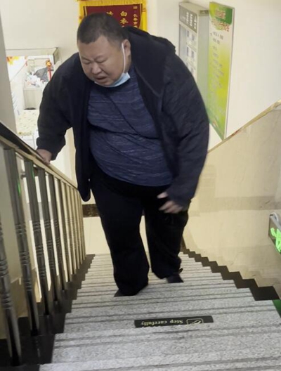 巨胖男子在长春康达医院减肥4个月瘦100斤，他的方法「不伤膝盖」3.jpg