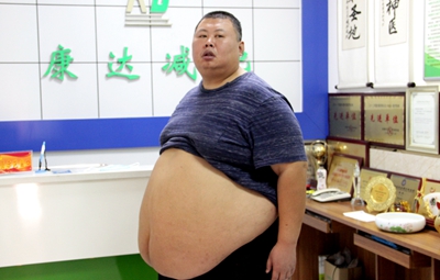 巨胖男子在长春康达医院减肥4个月瘦100斤，他的方法「不伤膝盖」5.jpg