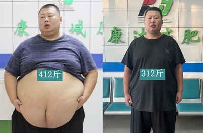 巨胖男子在长春康达医院减肥4个月瘦100斤，他的方法「不伤膝盖」9.jpg