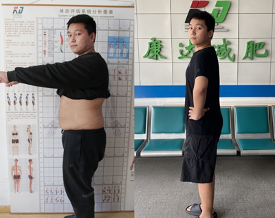 为找到理想工作，22岁胖男孩来长春康达减肥，3个月瘦57斤！2.jpg