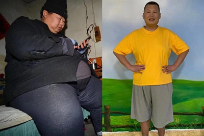 长春康达医院专家提醒 腹型肥胖一旦出现,糖尿病患病风险将增加6-20倍2.jpg