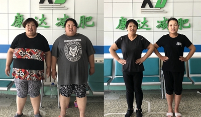 冬天易发胖！长春康达 这些穴位可以帮助减肥1.jpg