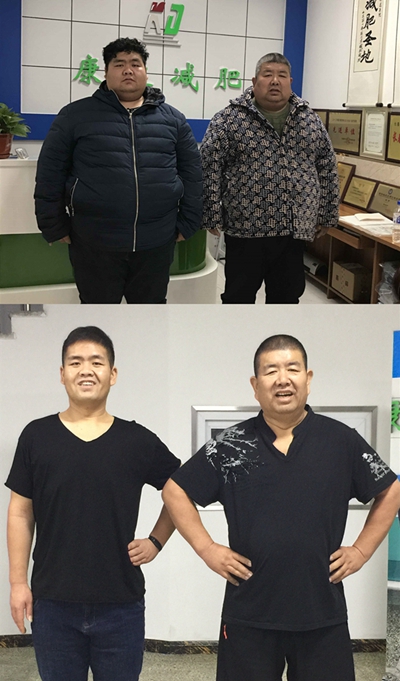 长春康达减肥医院：晚上10点后睡觉更易肥胖和腰围过大3.jpg