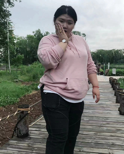 长春康达医院提醒：为骨感美来医院减肥是误区2.jpg