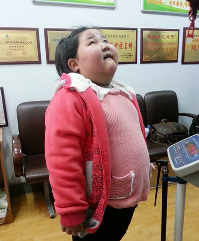 每5个孩子中就有1个体重超标，康达减肥 中西医”协同防胖”效果更好3.jpg